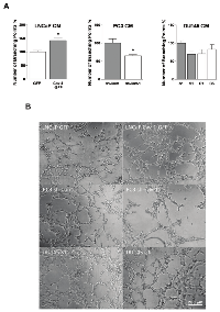 Figure 4:  Effect of Cav-1 expression in prostate cancer cells on in vitro  lymphangiogenesis. (A) 