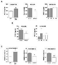 Figure 5:  Effect of Cav-1 expression in prostate cancer cells on lymphangiogenesis-promoting growth factors. (A) 