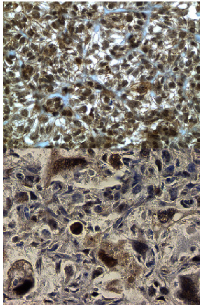 Figure 1: Morphoproteomic analysis of mTOR  expression: 