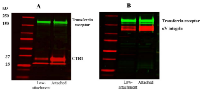 Figure  3:  Effect  of  preventing  M21  cell  attachment  on  CTR1  and  αV  expression. 