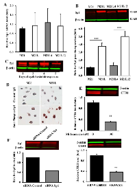 Figure 6: Loss of αV integrin enhances the expression  of Sp1. 