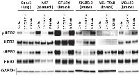 Figure 3:  HER3 is trans- phosphorylated by HER2 but not by EGFR. 