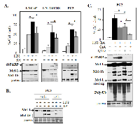 Figure 1: 1198 + BA combination increases  apoptotic and necrotic cell death in PCa  cells.  (A) 