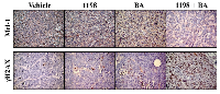 Figure  3:  1198  +  BA  decreases  Mcl-1  and  increases  DNA  damage-associated  γH2AX  in  TRAMP  PCa. 