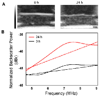 Figure 1: Representative ultrasound data acquired in vitro. 