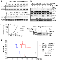 Figure 1: EFEMP1 targets EGFR/EKR/AKT oncogenic pathways to suppress tumorigenicity. 