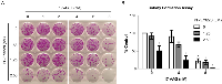 Figure 2:  Combinations of FAK and Hsp90 inhibitors reduce long term colony formation of H460 cells. 