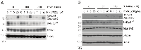 Figure 5:  Co-treatment with Hsp90 and FAK inhibitors increases apoptotic markers in H460 cells. 