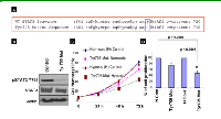 Figure 3:  STAT3 Tyr705 activation is important for cell proliferation in hypoxic ovarian cancer cells. 