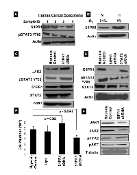 Figure 4:  S1PR1 expression in HOCCs induces STAT3 activation. 