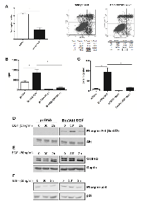 Figure 3:  BCR/ABL-OOF induces cellular proliferation, migration and survival. 