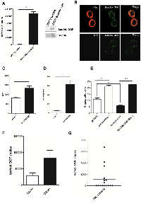 Figure 4:  BCR/ABL-OOF can cooperate with BCR/ABL oncogenicity. 