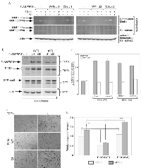 Figure  1: PIAS1  acts  in  a  SUMO  E3  ligase-dependent  manner  to  suppress  TGFβ-induced  MMP2  activity  and  invasiveness  of  MDA-MB-231  breast  cancer  cells. 