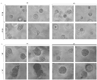 Figure 2:  TGFβ induces disorganization and budding of MDA-MB-231 breast cancer cell-derived organoids. 