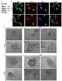 Figure 3:  Knockdown of endogenous PIAS1 enhances TGFβ-induced disorganization of MDA-MB-231 breast cancer  cell-derived organoids. 