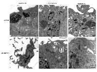 Figure 10:  Ultrastructure images of cells treated with ceramide or fumonisin B1, or monensin. 
