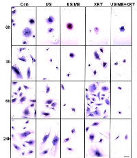 Figure 1: Light microscopy images of haematoxylin and eosin stained HUVEC cells. 