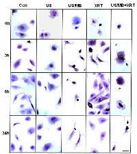 Figure 2:  Light microscopy images of TUNEL-labelled HUVEC cells. 