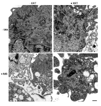 Figure 3:  Electron micrographs of the control group under different treatment conditions. 