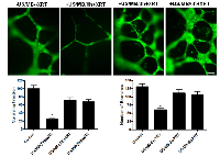 Figure 4:  Time interval between the individual treatments of US/MB and XRT. 