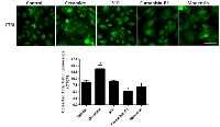 Figure 8:  Fluorescent labeling of ceramide in control cells that were not treated or were treated with different  modulators. 