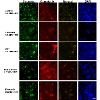 Figure 9:  Fluorescent triple labeling of ceramide, complexIV, and DAPI in US/MB+XRT treated cells. 