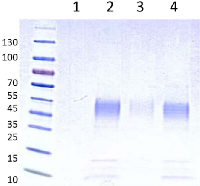 Figure 1: SDS-PAGE analysis of hrRNASET2. 