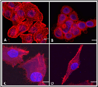 Figure 4:  The effect of hrRNASET2 on cancer cell morphology.  