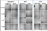 Figure 6:  hrRNASET2-driven inhibition of HUVEC tube formation. 