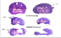 Figure 8:  hrRNASET2-driven inhibition of tumor growth. 