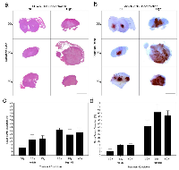 Figure 1: Gross tumor histopathology of MDA-MB-231 human breast tumor xenografts after ultrasound-microbubble  and radiation treatments. 