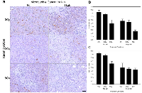 Figure 3:  CD31 stained tumors showing microvascular disruption after treatment. 