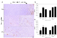 Figure 4:  Factor VIII stained xenografts showing vascular leakage after tumor treatment. 