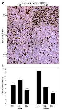 Figure 6:  Ki-67 stained histological sections showing  the growth fraction of the cell population. 