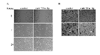 Figure 2:  miR-125a-3p impairs cells motility. 