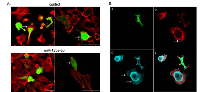 Figure 5:  Polymerization of actin filaments. 