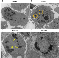 Figure 4:  Transmission electron microscopy of MDA-MB-231 cells.