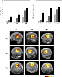 Figure 2:  Changes in quantitative ultrasound parameters with treatment and corresponding parametric maps of the  mid-band fit.