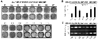 Figure 3:  Detection of cell invasiveness.