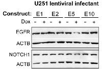 Figure 6:  Immunoblotting EGFR and NOTCH 1.
