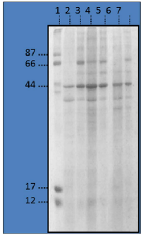 Figure 1: Electrophoresis profile of prostate human tissue.