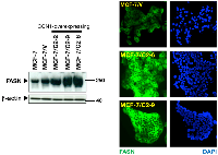 Figure 1: CCN1-overexpressing MCF-7 breast cancer cells up-regulate FASN protein expression.