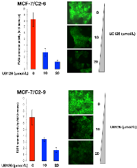 Figure 4:  CCN1 overexpression up-regulates FASN via  activation of the ERK/MAPK pathway.