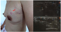 Figure 1: Initial clinical manifestation of the patient.