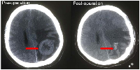 Figure 4:  Cranial computerized tomography (CT).