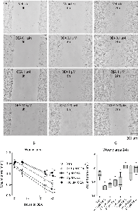 Figure 5:  Effects of OEA on B16 cell migration and wound closure in culture. 