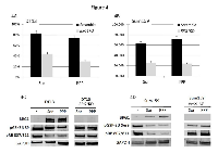 Figure 4A and 4B: DT13, a BRG1-de cient breast cancer cell line, was stably transduced with scrambled shRNA or anti- BRG1 shRNA. Each of the resultant four daughter cell lines were treated with 5 Î¼M Sorafenib or 2 Î¼M Picropodophyllin over 96 hours. The degree of growth inhibition after Sorafenib or Picropodophyllin (PPP) treatment was measured and is shown in Figure 3A (DT13) and Figure 3B (Sum159) for each of these cell lines expressing either scrambled or anti-BRG1 shRNA. Figure 4C shows that the DT13 cell line was stably transduced with either scrambled or anti-BRG1 shRNA. Each of these two daughter cell lines was then treated with Sorafenib or PPP, and after 96 hours, protein was extracted and a western blot was performed using antibodies against BRG1, GSK3Î² and GAPDH (loading control). The  rst lane indicates the vehicle-only- treated (DMSO) DT13 cells harboring the scrambled shRNA. Lanes 2 and 3 contain DT13 cells harboring scrambled shRNA and treated with Sorafenib or PPP, respectively. Lanes 4 and 5 contain DT13 cells treated with Sorafenib or Picropodophyllin, respectively; however, these cells also harbored anti-BRG1 shRNA, which blocked the induction of BRG1. GSK3Î² decreases with the treatment of these TKIs. However, BRG1 knockdown appears to block the TKI-driven downregulation of pGSK3Î² expression. Figure 4D shows Sum159, another BRG1-de cient cell line, that is stably transduced with either scrambled or anti-BRG1 shRNA. Lane 1 shows the Sum159 cells treated with vehicle-only scrambled shRNA. Lanes 2 and 3 show the two daughter Sum159 cell lines treated with scrambled shRNA and with Sorafenib or Picropodophyllin, respectively. Similarly, lanes 4 and 5 shows the Sum159 cells transduced with anti-BRG1 shRNA and after treatment with Sorafenib or Picropodophyllin. Sor= sorafenib and PPP= Picropodophyllin. GAPDH was used as the loading control.