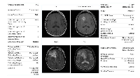 Figure 3:  Representative axial MR T1, T1 gadolinium contrast enhanced, fluid-attenuation recovery, and T2-weighted  acquisitions with corresponding VASARI scores.