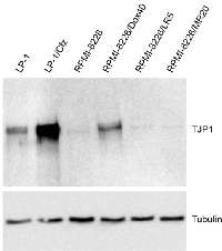 Figure 1: TJP1 protein levels are increased in  carfilzomib-resistant LP-1/Cfz cells. 