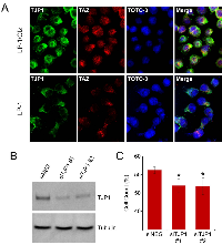 Figure 7:  Subcellular localization and knockdown of TJP1 in LP-1/Cfz cells. 